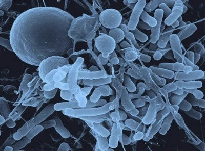 היתרונות של Bifidobacterium longum אורגני